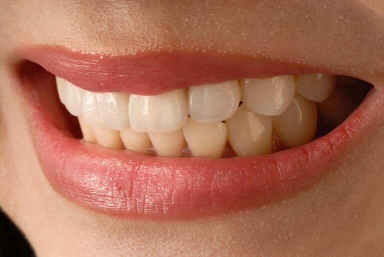 asian smile 3672997 960 720