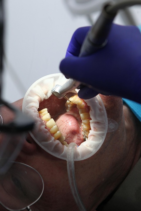 dentist 7397737 960 720