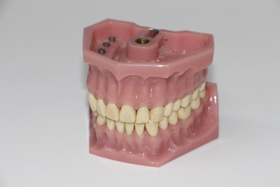 dentures 1514697 960 720