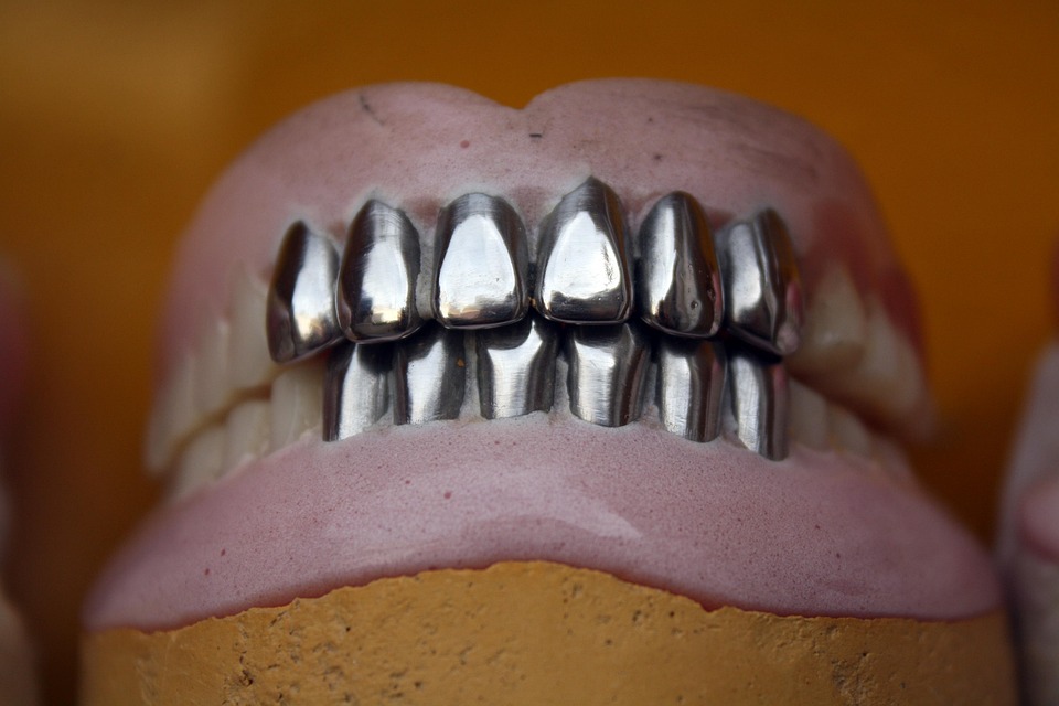 metal teeth 2431035 960 720