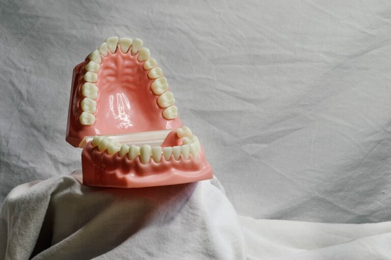 teeth 5522652 960 720