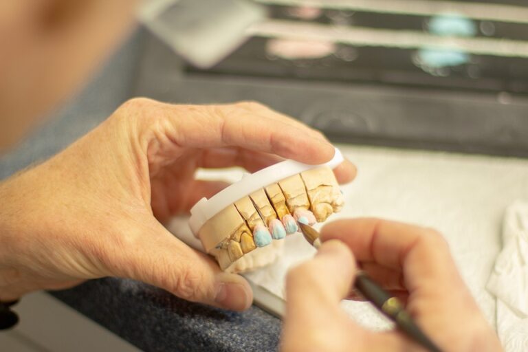 tooth replacement 3532980 960 720