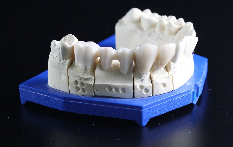 tooth replacement 759928 960 720
