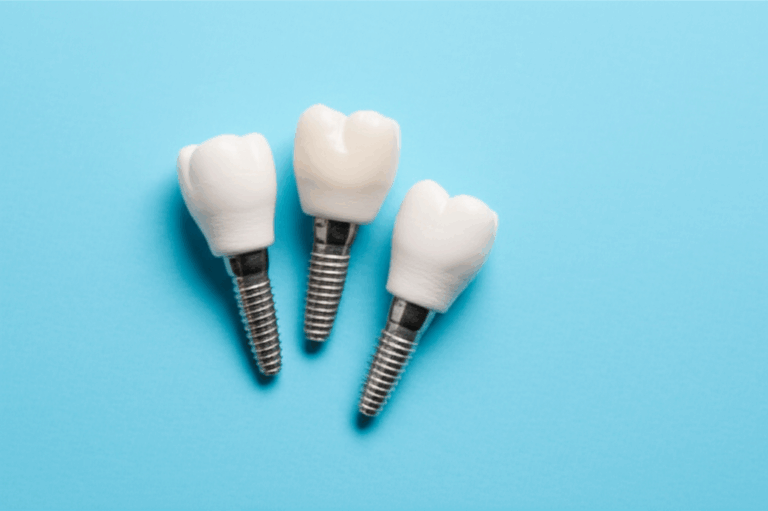 Does 32BJ SEIU Health Fund Cover Dental Implants Your Complete Compassionate Guide