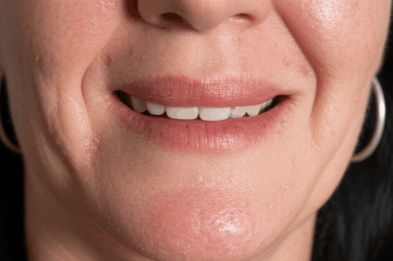 How Much Alcohol Causes Dental Implant Failure Understanding the Risks Protecting Your Investment