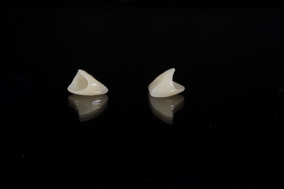 dental 2036941 960 720
