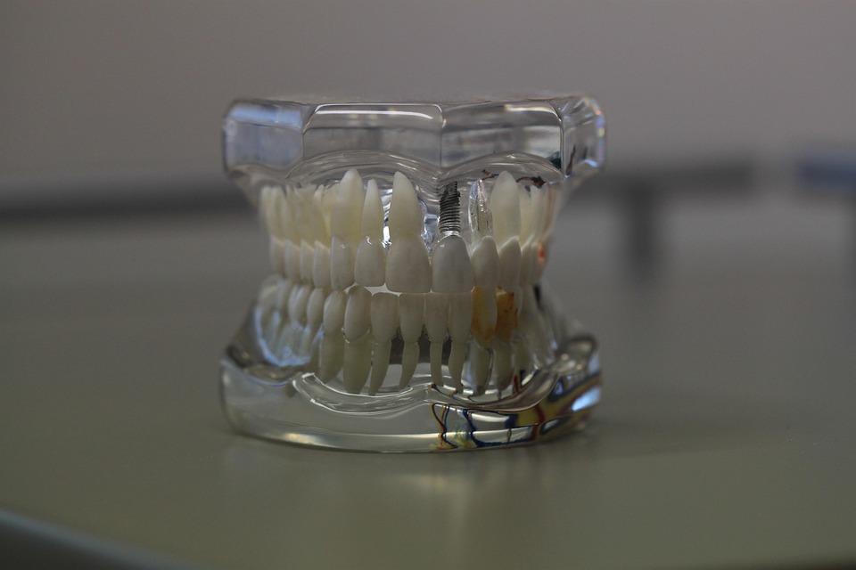 dentistry 668214 960 720