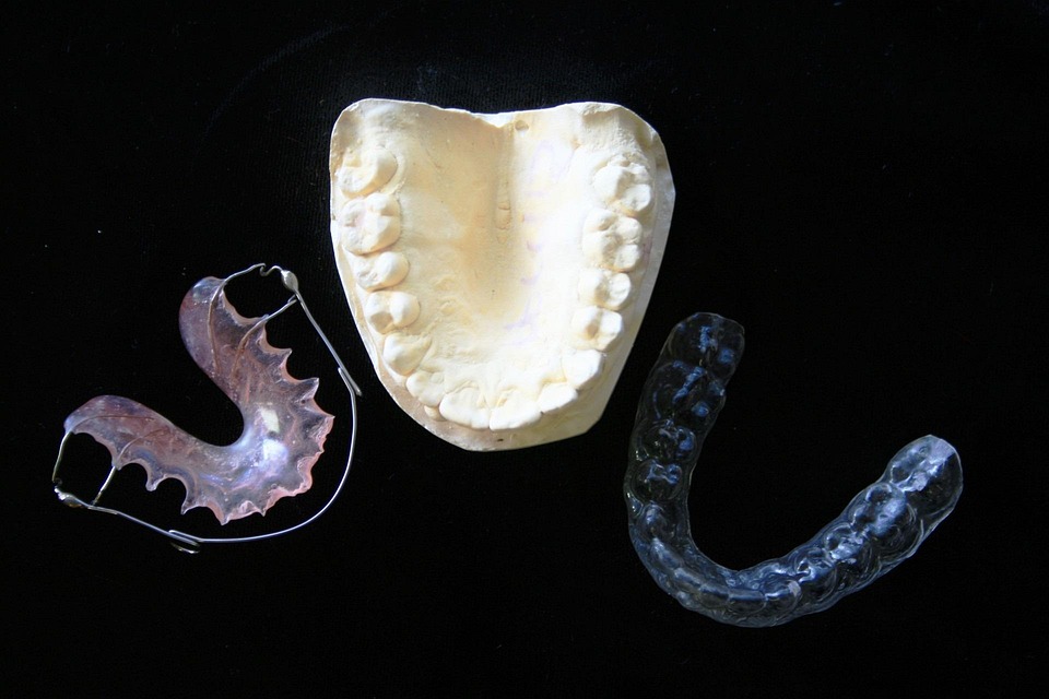 orthodontic 315784 960 720